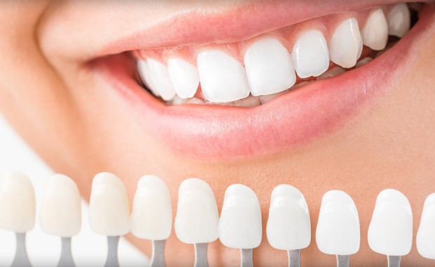 SEO for Dentists in Des Moines